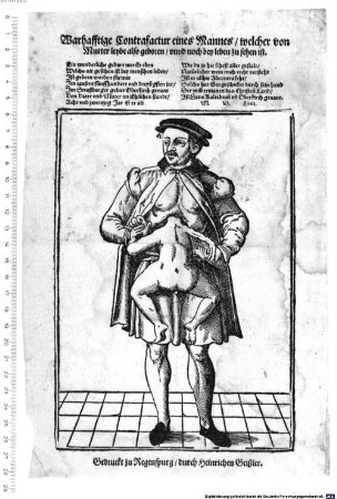 Warhafftige Contrafactur eines Mannes, welcher von Mutter leybe also geboren unnd noch bey leben zu sehen ist : Ein wunderliche geburt merckt eben Welchs nit gesehen ist bey menschen leben