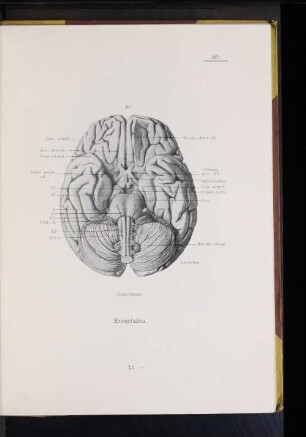 167 Gehirnbasis.