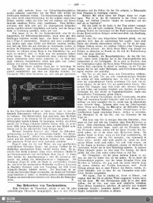 Das Behorchen von Taschenuhren