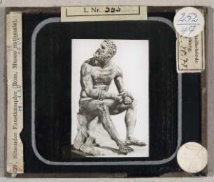 Rom, Museo Nationale: Sitzender Faustkämpfer (Krüss-Nr. 8629)