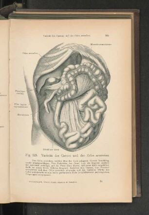 Fig. 329. Varietät des Caecus und des Colon ascendeus.