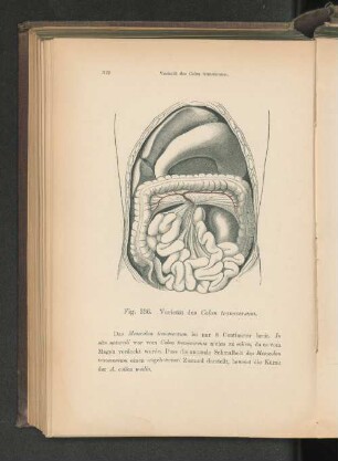 Fig. 336. Varietät des Colon transversum.