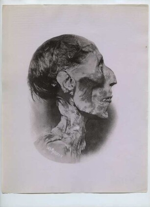Ägyptisches Museum, Kairo: Ansicht, Kopf der Mumie von Ramses II.