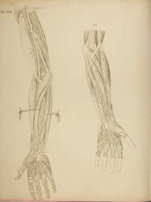 Beispiele von Anomalien im Arterienverlauf der Arme (Lineartafel)