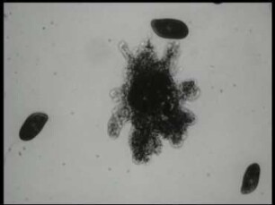 Amoeba proteus (Amoebina) - Nahrungsaufnahme und Fortpflanzung