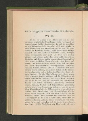 Akne vulgaris disseminata et indurata.