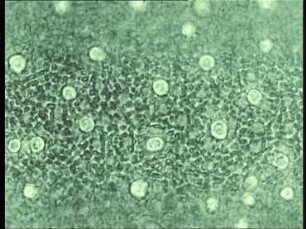 Ungeschlechtliche Fortpflanzung der Grünalge Hydrodictyon reticulatum