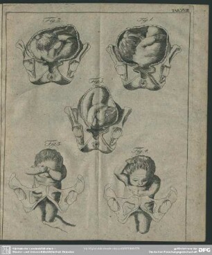 Tab. XVIII