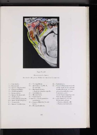Figur Nr. 253 Horizontalschnitt durch den Kopf in Höhe des harten Gaumens.