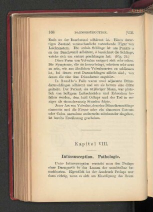 Kapitel VIII. Intussusception. Pathologie.