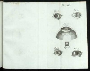 Tav. III. Fig. 1. [bis] Fig. 6.