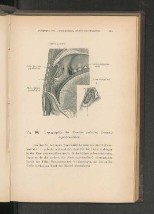 Fig, 162. Topographie der Tonsilla palatina, Recessus supratonsillaris.
