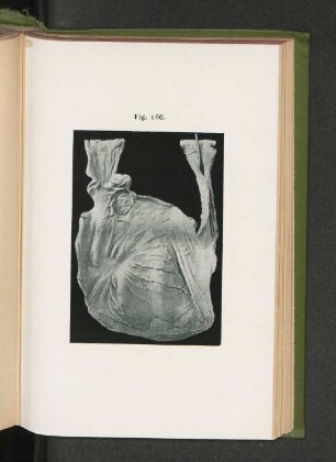 Fig. 186.