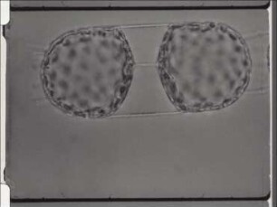 Asexual Reproduction in the Diatom Stephanopyxis turris (Centrales)