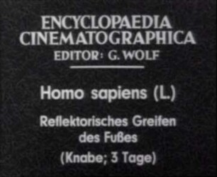 Homo sapiens - Reflektorisches Greifen des Fußes (Knabe, 3 Tage)