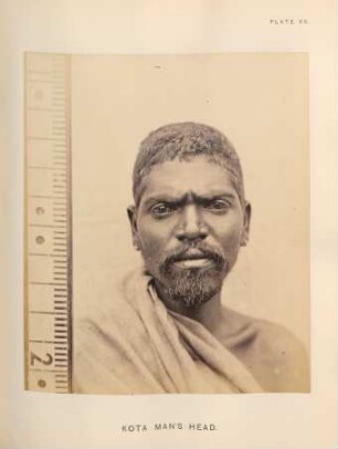 Kota man's head