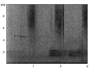 Wiesengrashüpfer | Chorthippus dorsatus - Stridulation