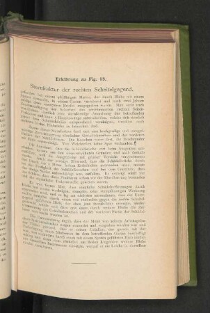 Erklärung zu Fig. 88.