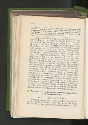 a) Torsion von Zähnen.