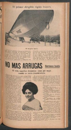 El primer dirigible rígido francés