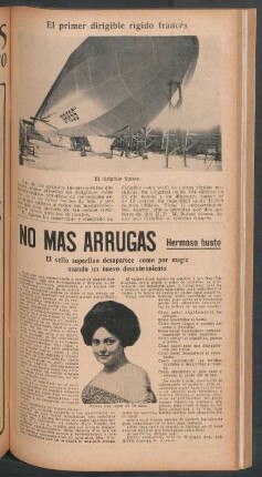 El primer dirigible rígido francés