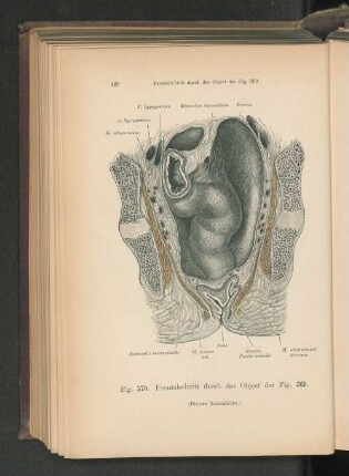 Fig. 370. Frontalschnitt durch das Object der Fig. 369.