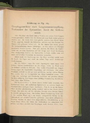 Erklärung zu Fig. 187.