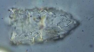 Tintinnidium sp. Sylt 2013