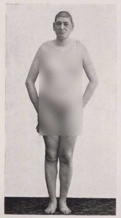 Fotografie, die den Patienten A. zeigt (1)