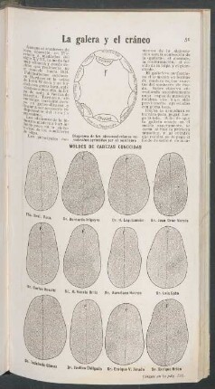 La galera y el cráneo