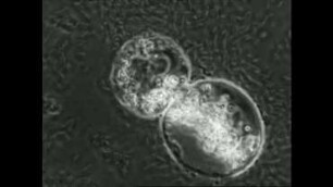 Chlamydophrys minor (Testacea) - Bewegung und Fortpflanzung