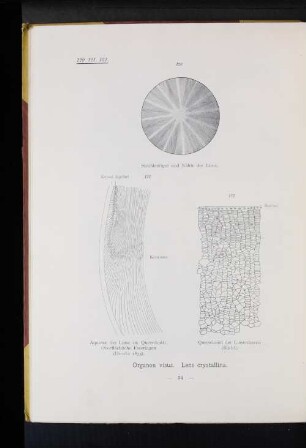 120 Strahlenfigur und Nähte der Linse.