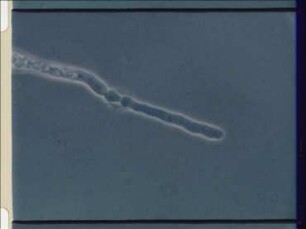 Befall von Nematoden durch Mycel- und Konidienfallen der Gattung Nematoctonus