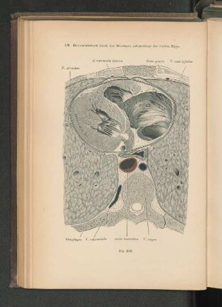 Fig. 266. Horizontalschnitt durch den Brustkorb entsprechend der vierten Rippe.