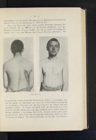 Fig. 30 u. 31.
