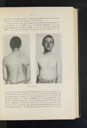 Fig. 30 u. 31.