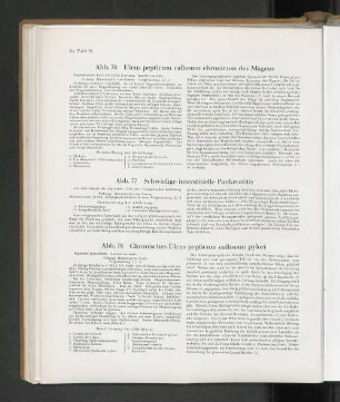 Abb. 77 Schwielige interstitielle Pankratitis
