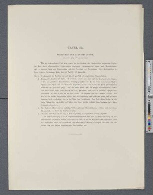 Tafel 21a. Perrücken der falschen Köpfe.