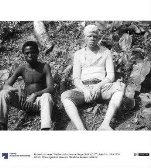 "Weißer und schwarzer Neger (Albino)" (OT)