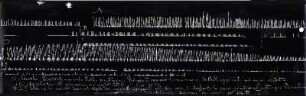 [Graphical recordings: fatigue]