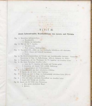 Tafel II. Acute Leberatrophie, Krystallformen von Leucin und Tyrosin.