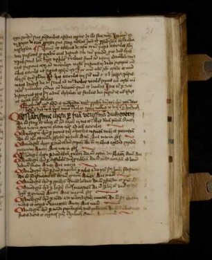 Centum et quinquaginta articuli psalterii.