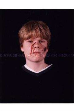 Junger Mann mit geschminkter Gesichtsverletzung (Zusätzlich eingereichtes Foto zum Sonderthema: Ein Bild von mir - Selbstporträts und Selbstdarstellungen)