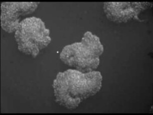 Bacillus anthracis - Morphologie und Verhalten bei verschiedenen Kulturbedingungen