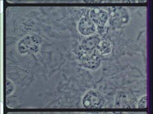 Genetic Determination of Plasmodium Formation in Physarum polycephalum (Myxomycetes)