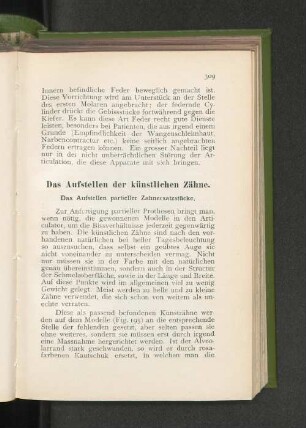 Das Aufstellen der künstlichen Zähnen.