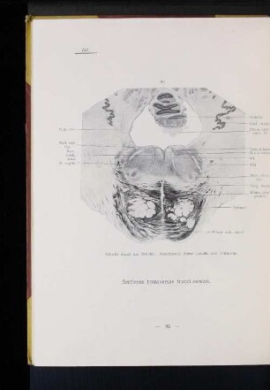 197 Schnitt durch die Brücke. Austretende Nervi facialis und abducens.
