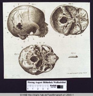 Anatomie eines menschlichen Schädels.