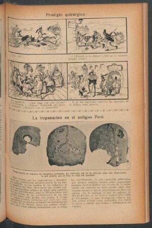 La trepanación en el antiguo Perú