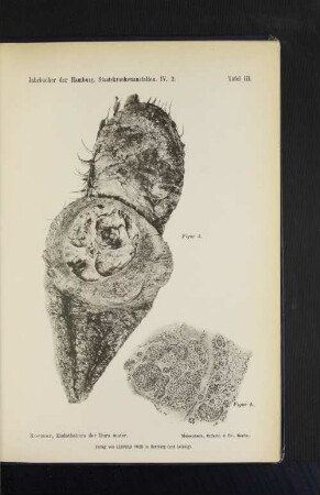Tafel III. Roemer, Endotheliom der Dura mater.